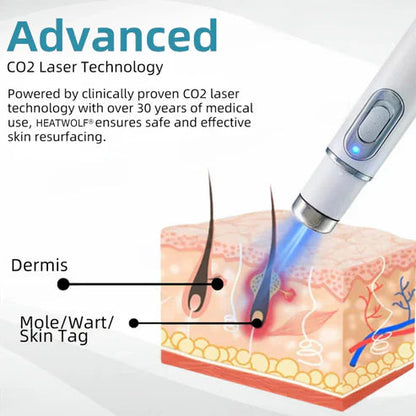 Mole Remover